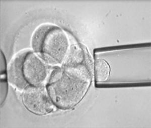 ¿Qué es el diagnóstico genético preimplantacional?